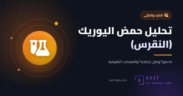 تحليل حمض اليوريك (النقرس): المعدل الطبيعي وأسباب الارتفاع وطرق خفضه